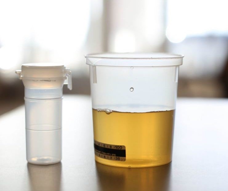 Synthetic Urine CVS Oak Tree Estates Vancouver WA